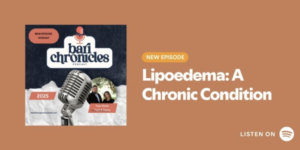 Learn more about lipoedema as Nadia Walton, Lymphoedema Physiotherapist talks about lipoedema: a chronic condition